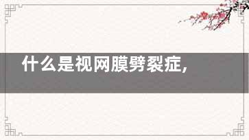 什么是视网膜劈裂症,什么是视网膜劈裂症图片