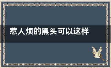 惹人烦的黑头可以这样去除