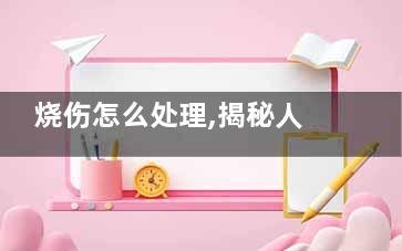 烧伤怎么处理,揭秘人人必知的8个急救方法,烧伤的人怎么办