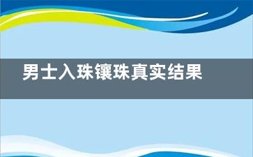 男士入珠镶珠真实结果大公开！半圈VS一圈哪个更好？附真人对比图分享！