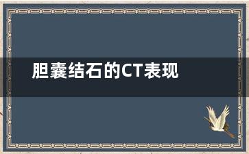 胆囊结石的CT表现