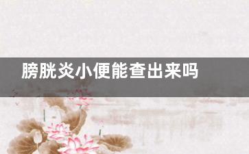 膀胱炎小便能查出来吗(膀胱炎尿液检查出来吗)