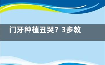门牙种植丑哭？3步教你选对牙冠材质+医生！