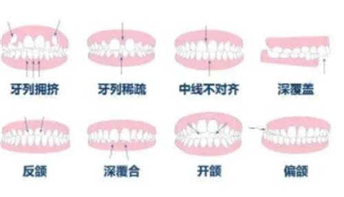 牙齿的常见问题