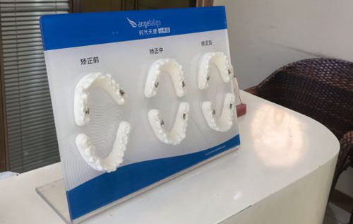 广州力德口腔牙齿矫正模型图