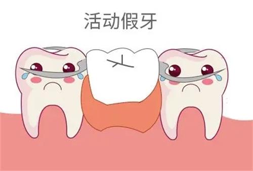 活动假牙图示