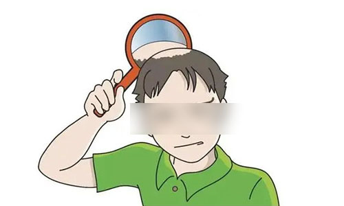头顶秃的动画图