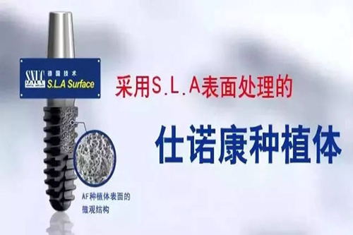 韩国仕诺康种植牙