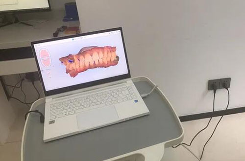 广州瑞博口腔牙齿治疗方案设计