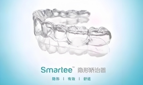 正雅隐形矫正的优点