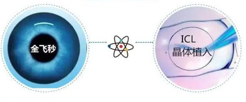全飞秒和晶体植入 全飞秒和晶体植入