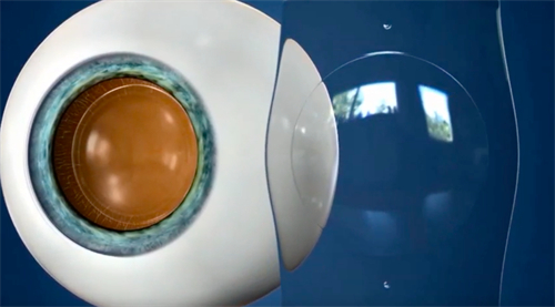 ICL晶体图展示 ICL晶体图展示