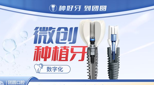 广州团圆口腔微创种植牙