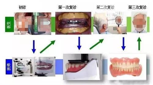 在嘉兴老年人做全口假牙多少钱？活动义齿2000+/固定义齿8000+/种植牙3w+