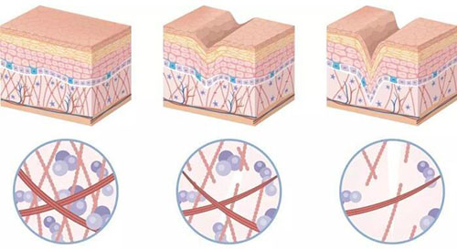 皮肤护理特点 皮肤护理特点