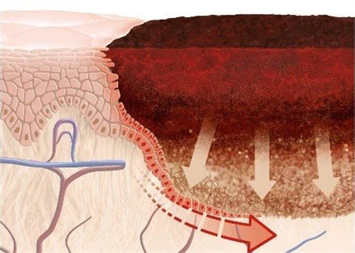 健康皮肤科和疤痕 健康皮肤科和疤痕