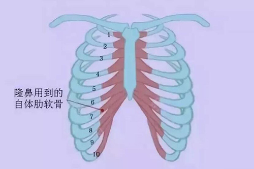 手术中一般用到的肋软骨材料