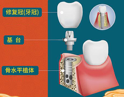 种植改善展示图照片