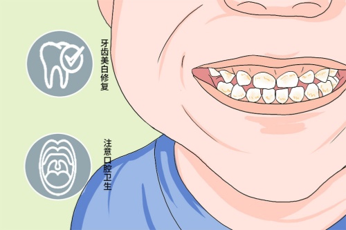 四环素牙卡通图