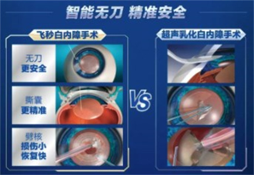 爱尔眼科做白内障免费是真的吗？真实有效，凡符合这几个条件都可向本地爱尔眼科申请