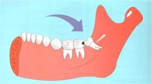 智齿的位置