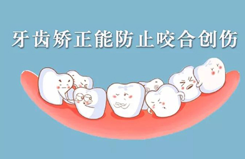 拥挤的牙齿