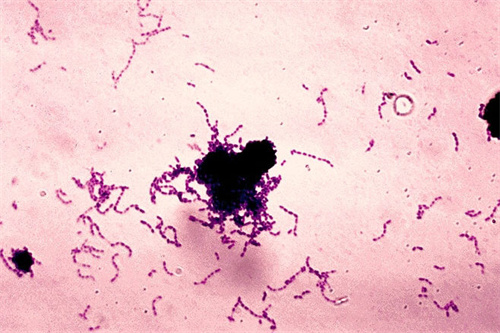 口腔细菌在电子显微镜下状态 口腔细菌在电子显微镜下状态