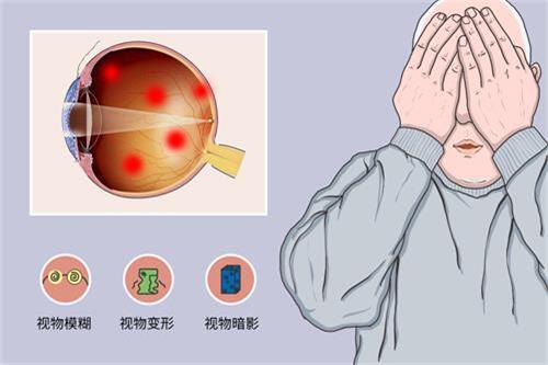 陕西正规眼科医院价格表:飞秒近视手术1.2W元起,白内障手术4500元起...