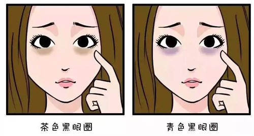 不同的黑眼圈