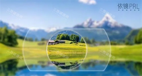 依镜PRL晶体植入术