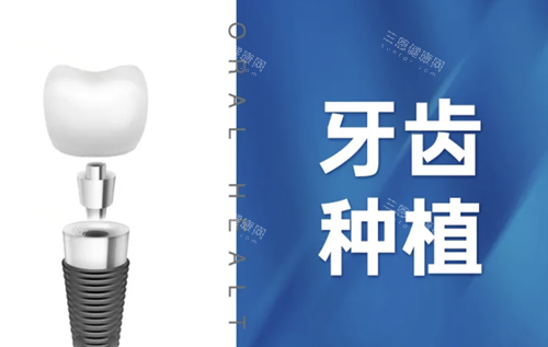 乐莎莎口腔种植牙