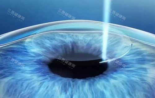 飞秒激光展示图 飞秒激光展示图