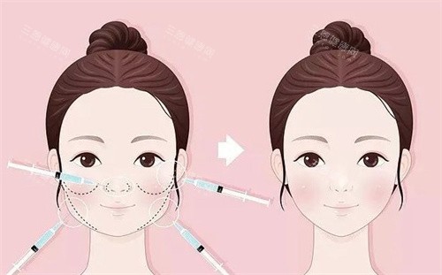 馒化脸修复前后