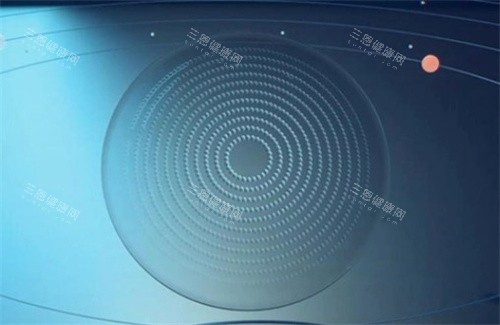 星趣控镜片