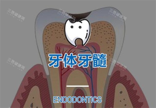 根管治疗改善图