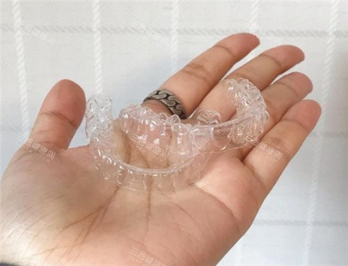 牙套示意图