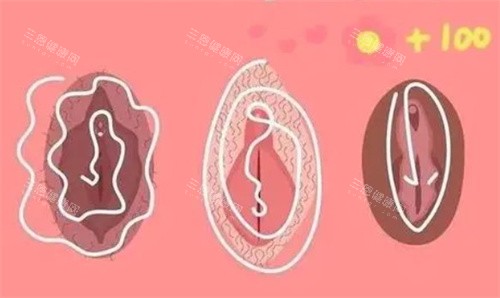 私密漂红卡通图 私密漂红卡通图