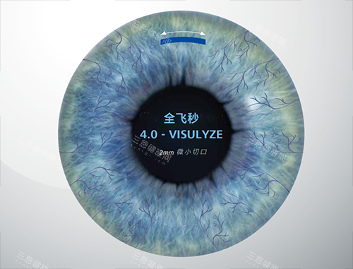 全飞秒4.0