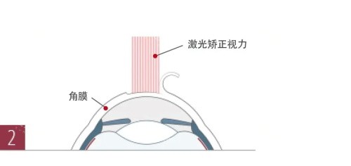 海南省人民医院眼科很正规。附眼科简介和预约方式！