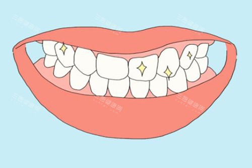 盐城中喜口腔牙齿美白改善图展示