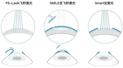 西安存济眼科医院2025价格表一览表在线查询入口!青光眼,白内障,近视...