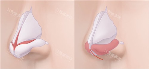 整容医院在线询问免费-在线预约国内整形医院-整形医院医生坐诊信息挂号方式在线询问