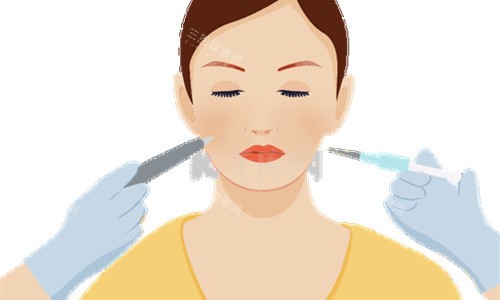 水光注射图 水光注射图