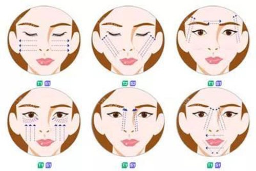 不同位置的面部提升示意图 不同位置的面部提升示意图