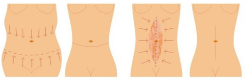 不同程度的腰腹 不同程度的腰腹
