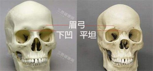 眉弓骨对比展示骨骼图 眉弓骨对比展示骨骼图
