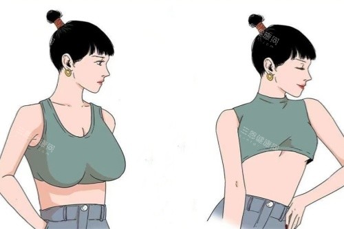 大胸缩小卡通对比图 大胸缩小卡通对比图