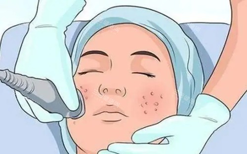 抚州德尔美客整形面部美容卡通示意图 抚州德尔美客整形面部美容卡通示意图