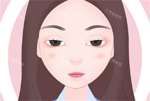 上眼睑下垂1 上眼睑下垂1