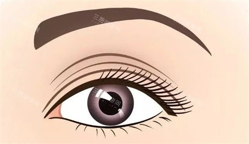 多眼皮 多眼皮
